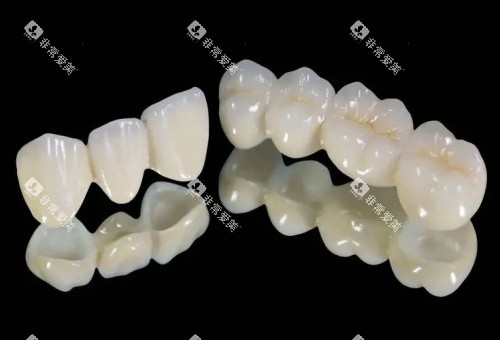 国产爱尔创全瓷牙 国产爱尔创全瓷牙