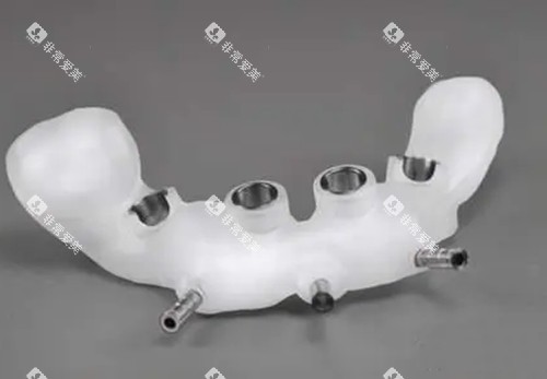 种植导板实物示意图 种植导板实物示意图