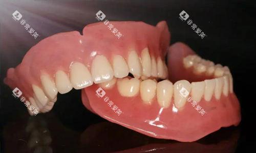 吸附性义齿图片 吸附性义齿图片