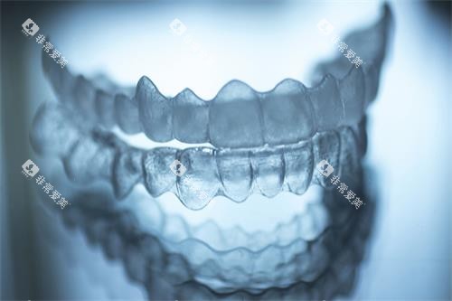 全隐形牙套示意图