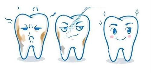 洗牙后的成效 洗牙后的成效