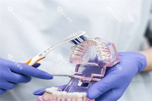牙齿护理模型图