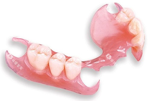 德国无挂钩假牙模型图