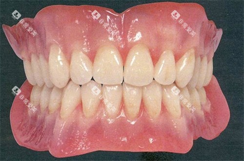 还原真牙的全瓷牙 还原真牙的全瓷牙