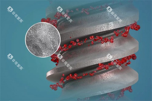 德国ABT种植牙表面结构