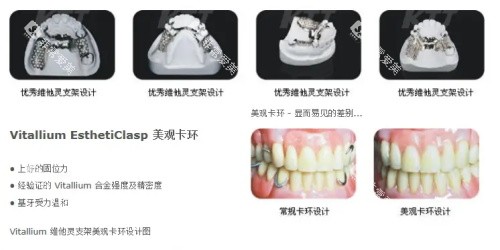 维他灵支架介绍示意图