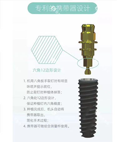 百康特种植牙六角设计优势图片