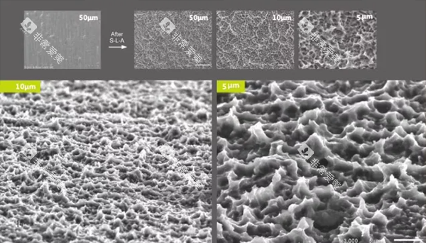 百康特种植牙设计优势