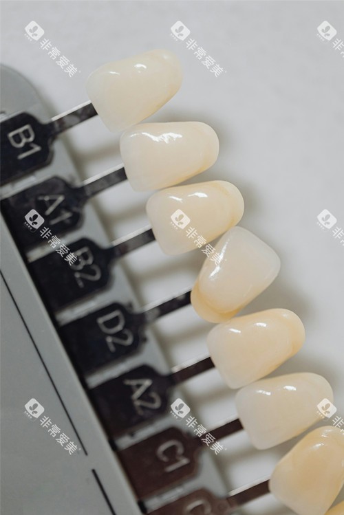 全瓷牙色号
