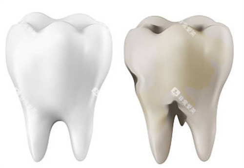 正常牙齿和坏的牙齿 正常牙齿和坏的牙齿