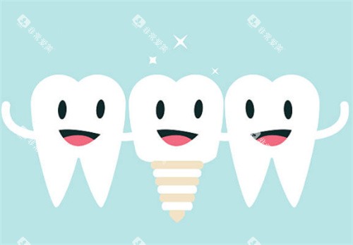 种植牙和健康牙齿图 种植牙和健康牙齿图