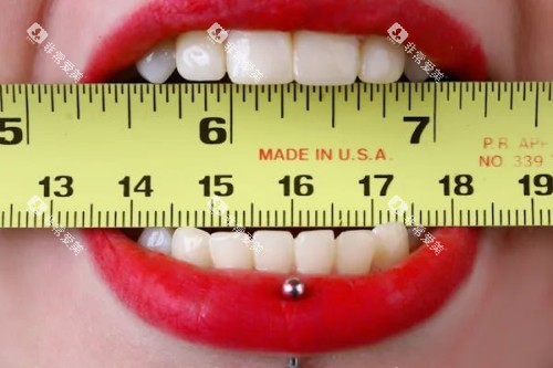 健康的牙齿 健康的牙齿