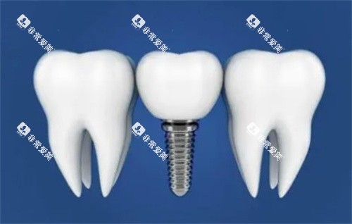 1753784202135969.jpg 1753784201992731.jpg