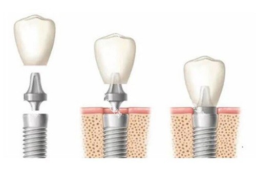 1753784205242119.jpg 1753784204280688.jpg