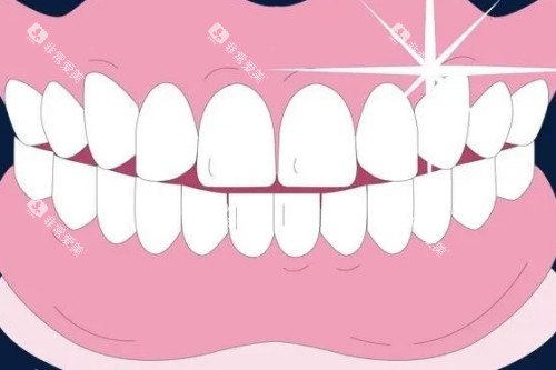 整齐牙齿卡通图