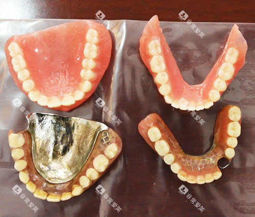 不同材料的义齿实物展示图