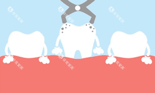 拔除龋齿展示