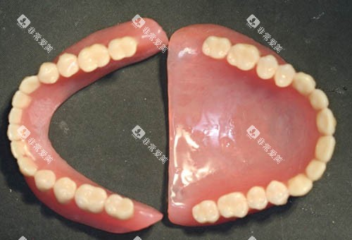全口假牙照片