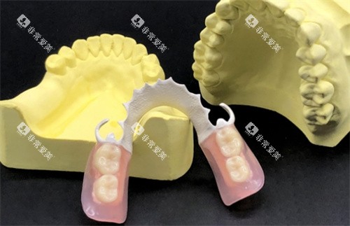 hpp粘接桥实物