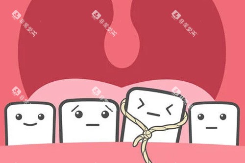 乳牙滞留拔除示意图