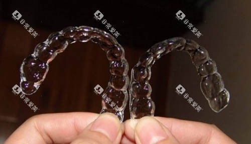 一组隐形牙套照片 一组隐形牙套照片