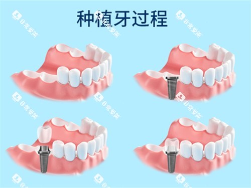 1754385122821918.jpg 1754385121674406.jpg