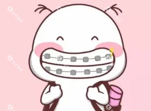 金属自锁牙套示意图 金属自锁牙套示意图