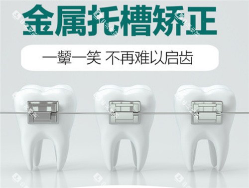 金属托槽矫正图 金属托槽矫正图