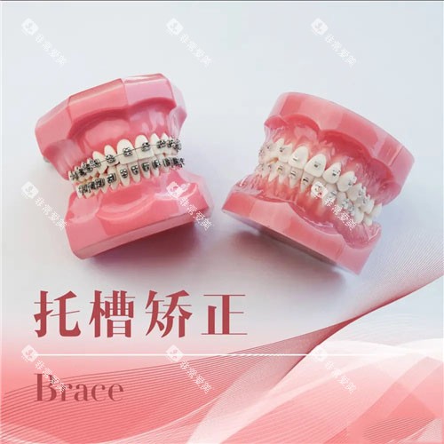 两种不同的托槽矫正 两种不同的托槽矫正