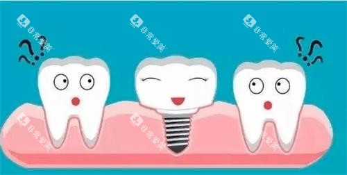 种植牙漫画演示图 种植牙漫画演示图
