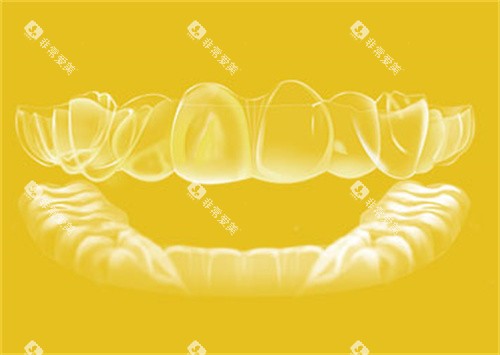 丽绮美隐形矫正器