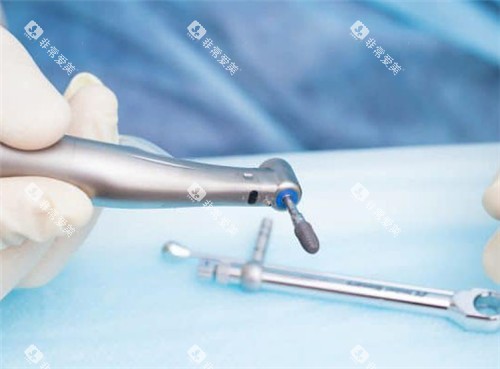 医生取出的种植体
