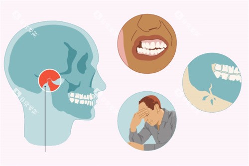 颞下颌关节紊乱引起的问题