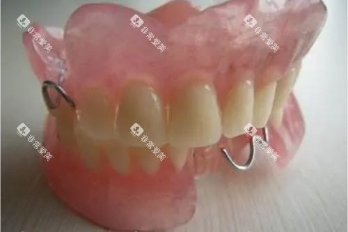 活动假牙图片一览