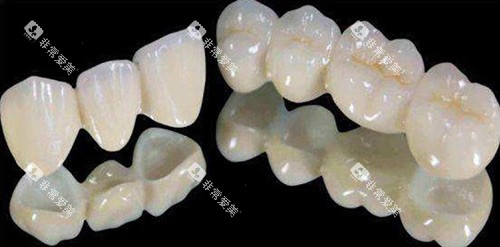 全瓷牙冠示意图