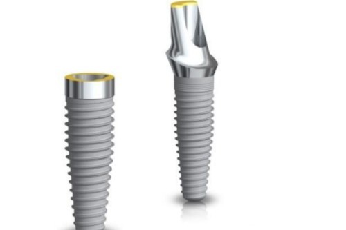 种植牙植体模型图