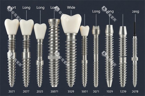 种植牙不同类型图