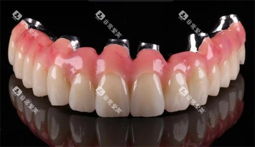 马龙桥种植牙技术 马龙桥种植牙技术