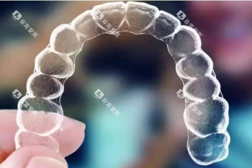隐形矫正器模型图 隐形矫正器模型图
