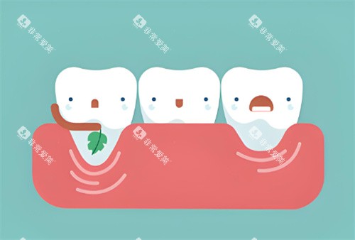 牙龈萎缩卡通示图