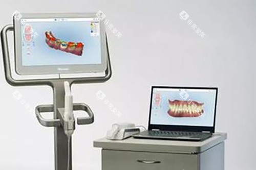 数字化牙齿矫正示意图