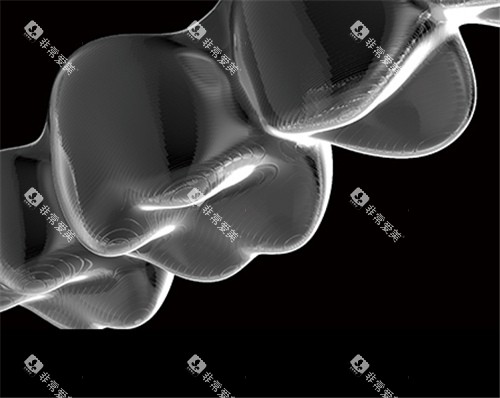 美立刻隐形矫治器图片 美立刻隐形矫治器图片