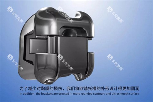 欧晴自锁托槽 (15) 欧晴自锁托槽 (15)