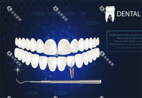 牙齿卡通图示CJ图 牙齿卡通图示CJ图