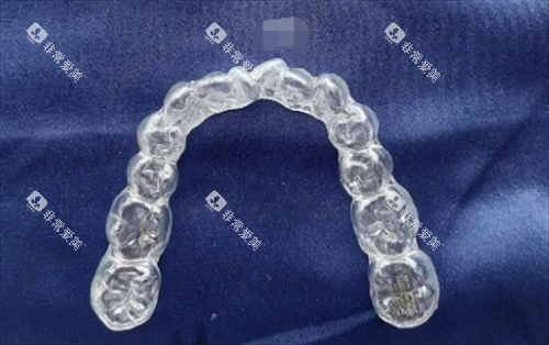 时代天使隐形矫正器