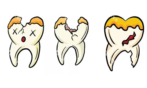 牙齿坏了一半动画图 牙齿坏了一半动画图