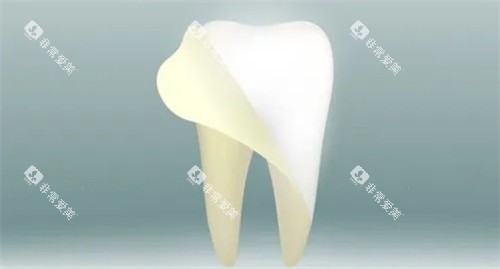 牙齿美白改善牙黄问题 牙齿美白改善牙黄问题