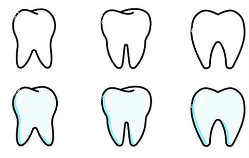 牙齿不同状态