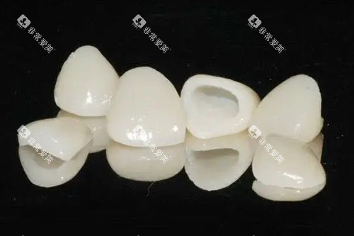 全瓷牙冠实物示意图 全瓷牙冠实物示意图