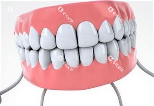 全瓷牙素材 全瓷牙素材
